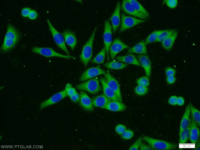 FOXO3A Antibody in Immunocytochemistry (ICC/IF)