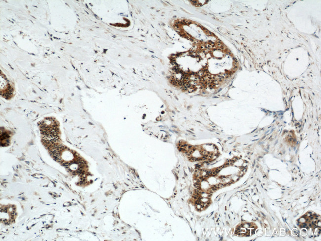 FOXO3A Antibody in Immunohistochemistry (Paraffin) (IHC (P))