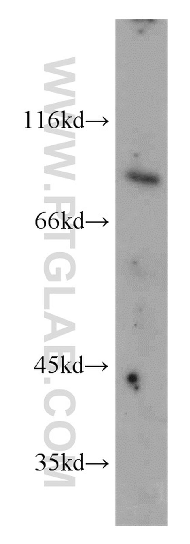 FOXO3A Antibody in Western Blot (WB)