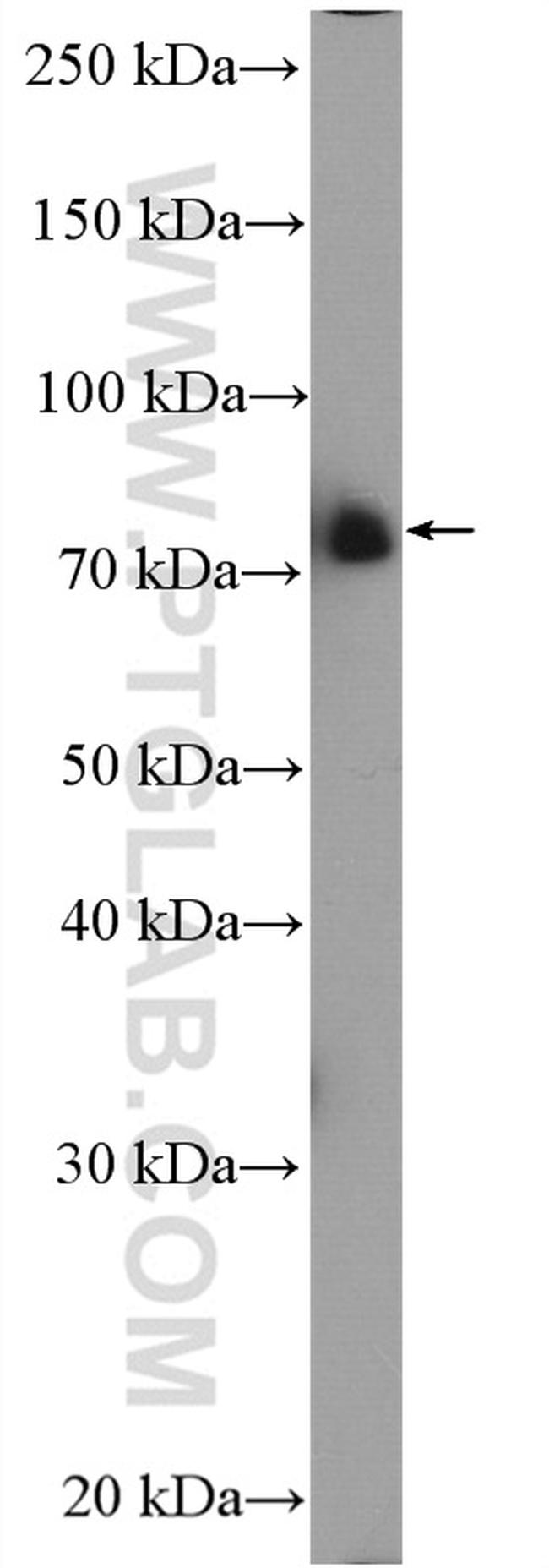 FOXO3A Antibody in Western Blot (WB)