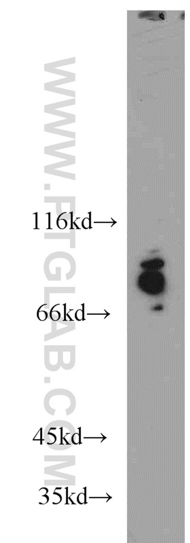 FOXO3A Antibody in Western Blot (WB)