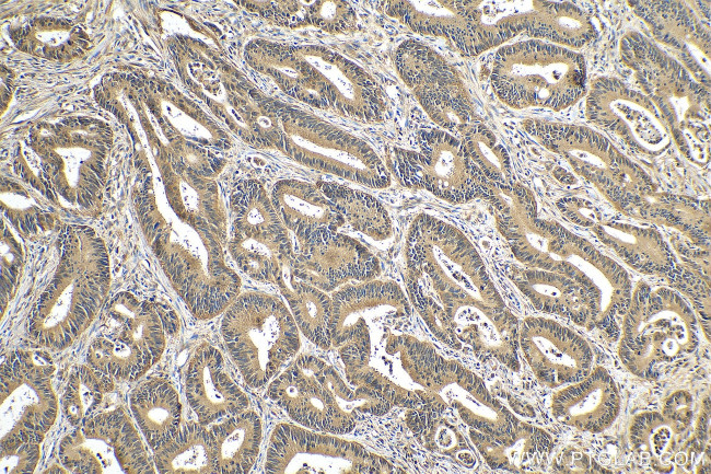 TRIM11 Antibody in Immunohistochemistry (Paraffin) (IHC (P))