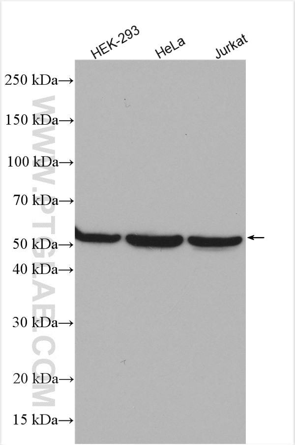 TRIM11 Antibody in Western Blot (WB)