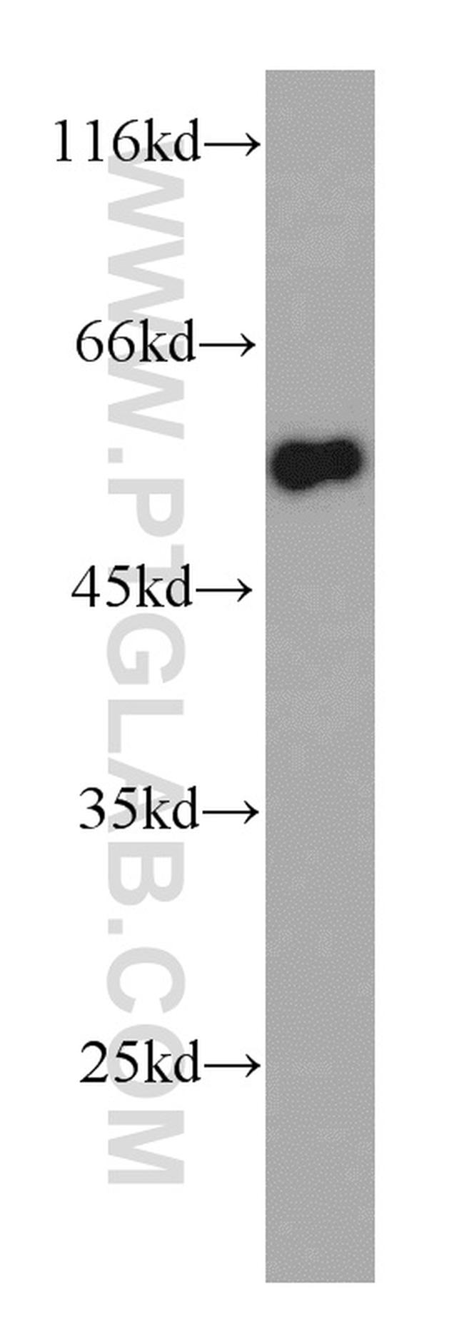 TRIM11 Antibody in Western Blot (WB)