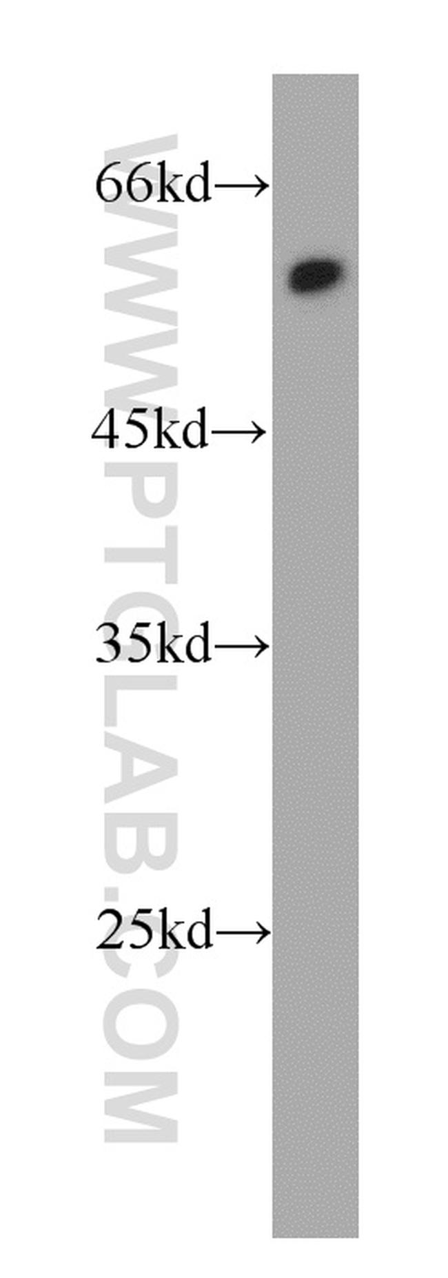 TRIM11 Antibody in Western Blot (WB)