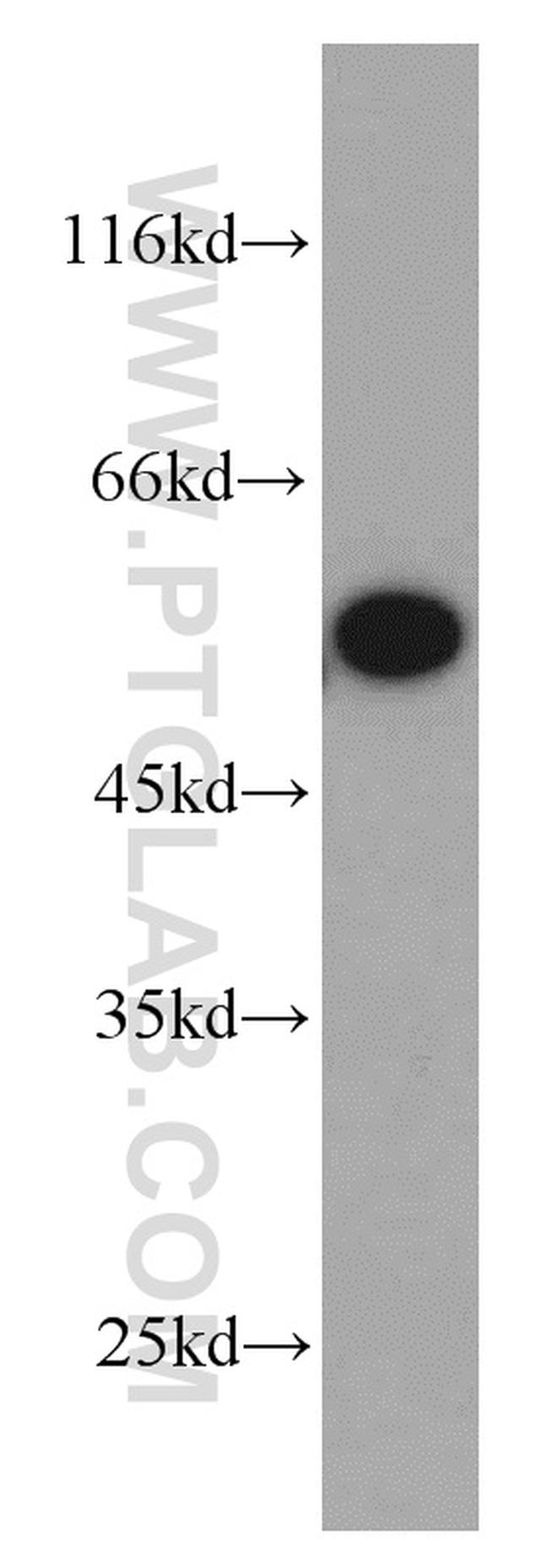 TRIM11 Antibody in Western Blot (WB)