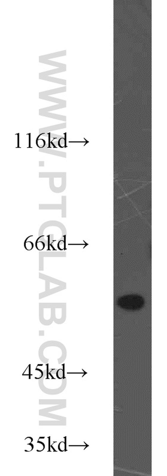 TRIM11 Antibody in Western Blot (WB)