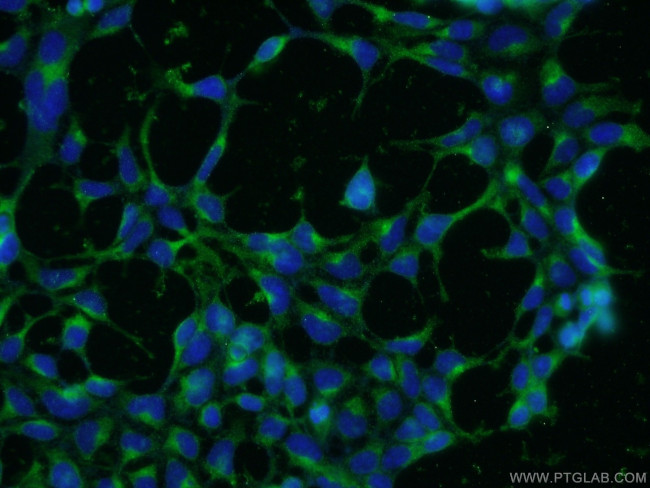 CLTA Antibody in Immunocytochemistry (ICC/IF)