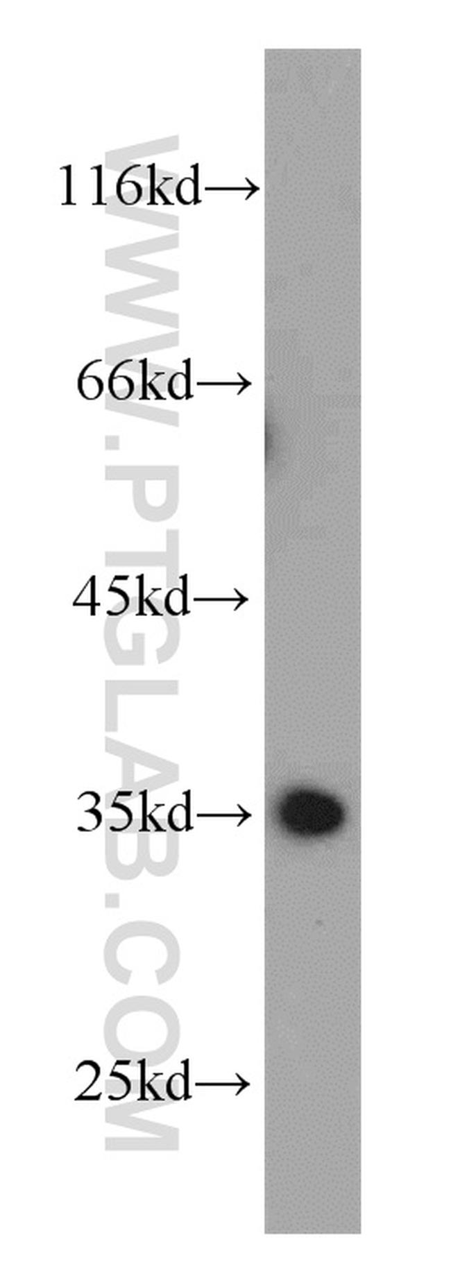 CLTA Antibody in Western Blot (WB)