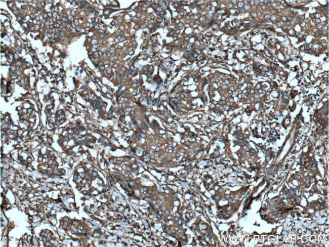 CLTA Antibody in Immunohistochemistry (Paraffin) (IHC (P))