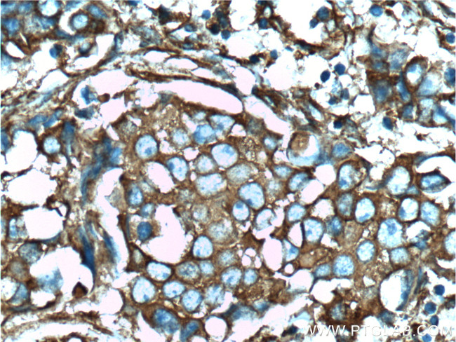 CLTA Antibody in Immunohistochemistry (Paraffin) (IHC (P))