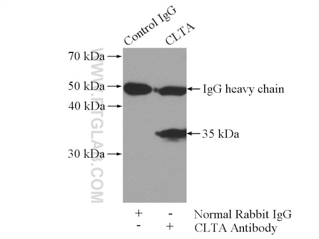 CLTA Antibody in Immunoprecipitation (IP)