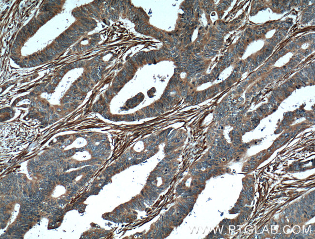 Palladin Antibody in Immunohistochemistry (Paraffin) (IHC (P))