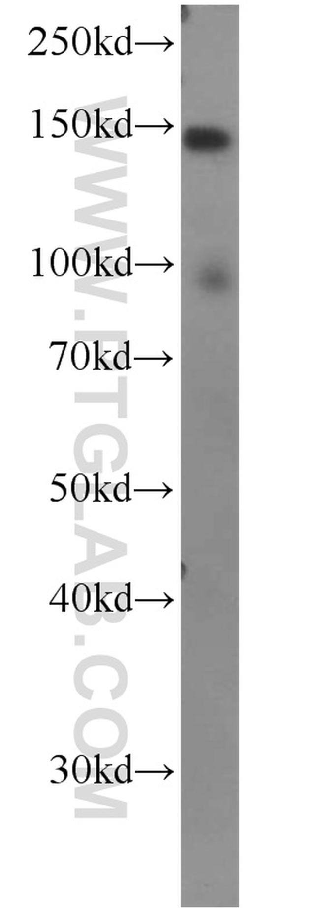 Palladin Antibody in Western Blot (WB)