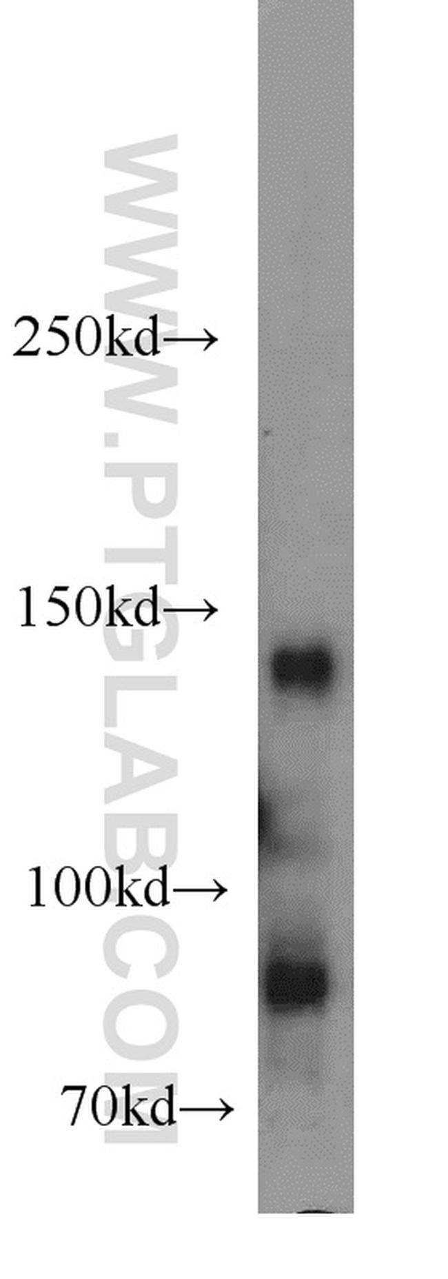 Palladin Antibody in Western Blot (WB)