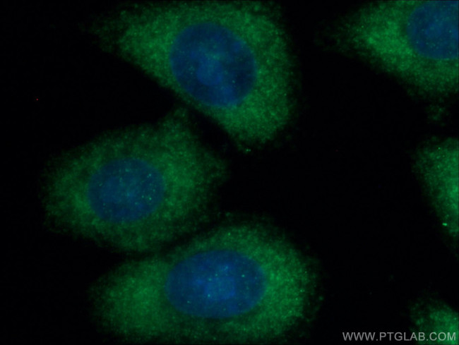 JP45/JSRP1 Antibody in Immunocytochemistry (ICC/IF)