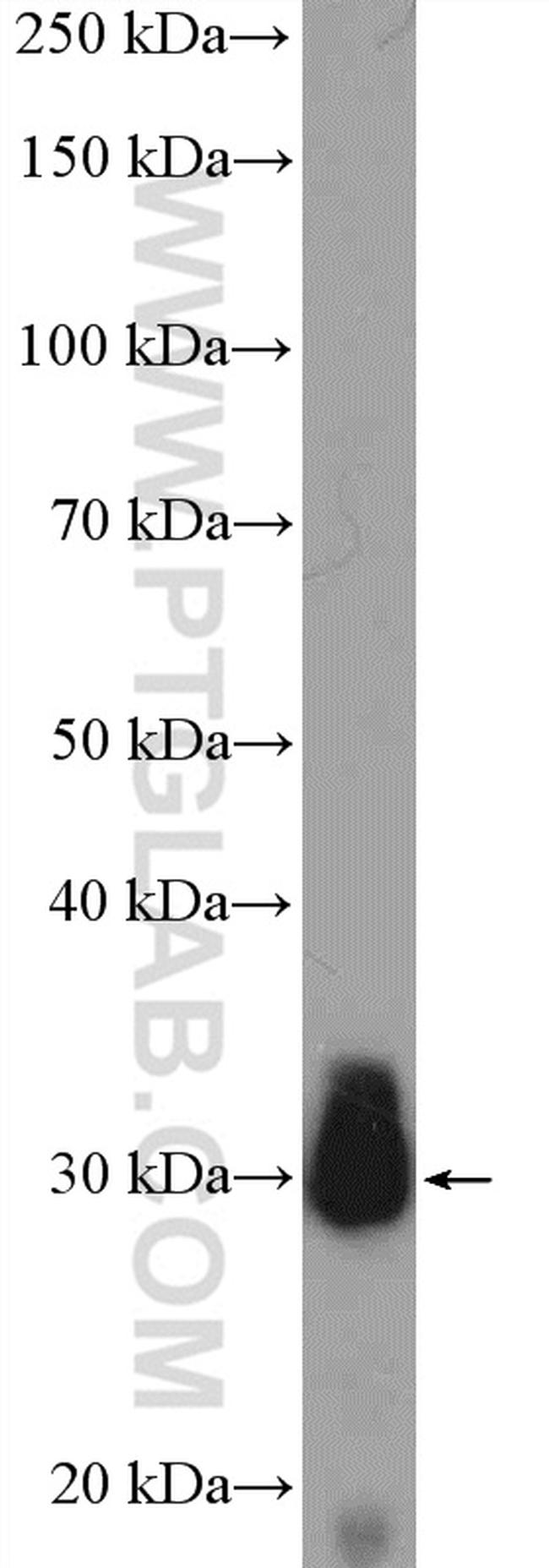 JP45/JSRP1 Antibody in Western Blot (WB)