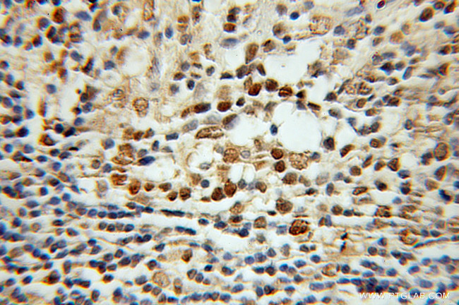 Histone H2A.X Antibody in Immunohistochemistry (Paraffin) (IHC (P))