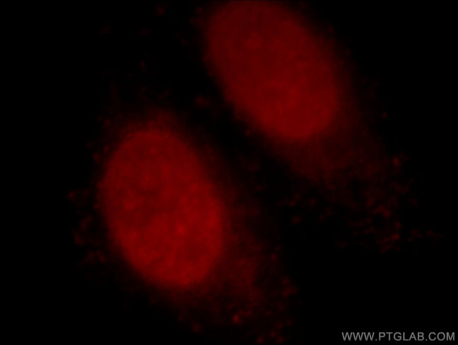 Histone H2A.X Antibody in Immunocytochemistry (ICC/IF)