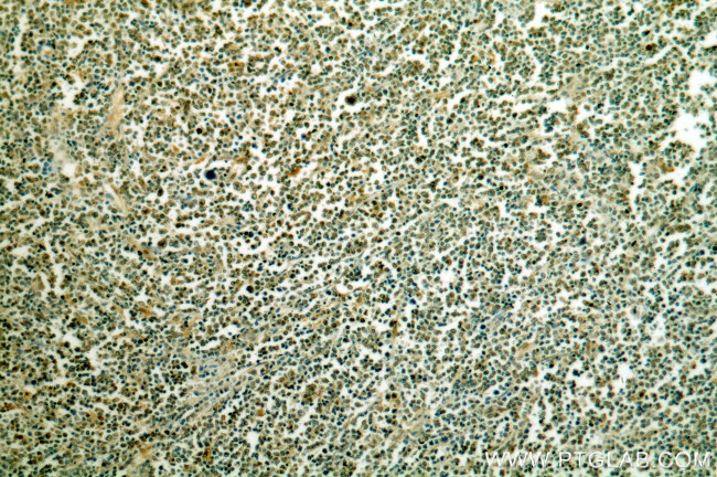 Histone H2A.X Antibody in Immunohistochemistry (Paraffin) (IHC (P))