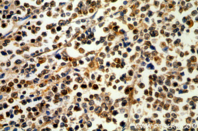 Histone H2A.X Antibody in Immunohistochemistry (Paraffin) (IHC (P))