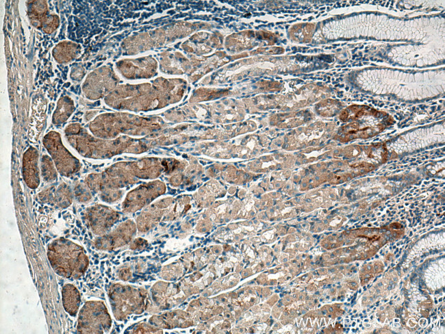 Timp-3 Antibody in Immunohistochemistry (Paraffin) (IHC (P))