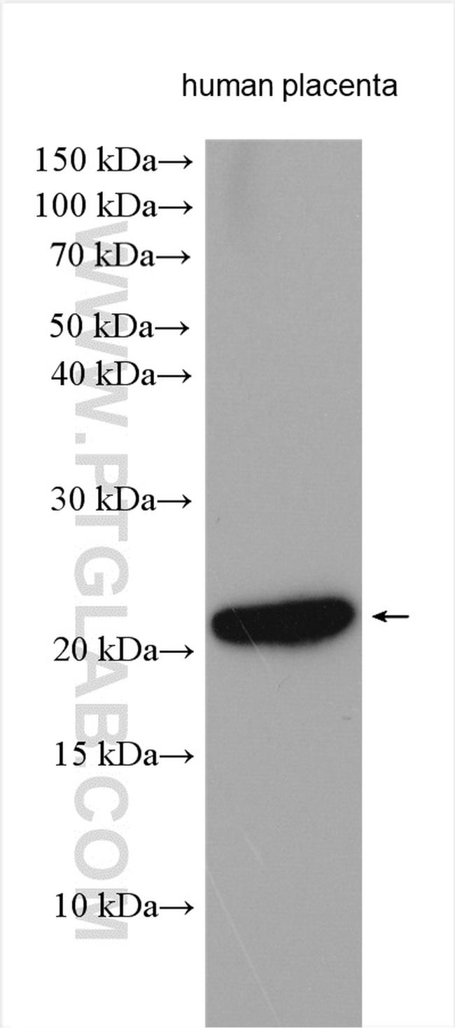 Timp-3 Antibody in Western Blot (WB)