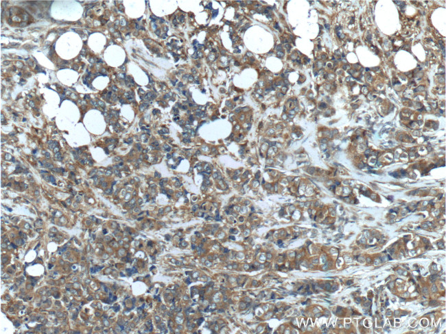 PKC zeta Antibody in Immunohistochemistry (Paraffin) (IHC (P))