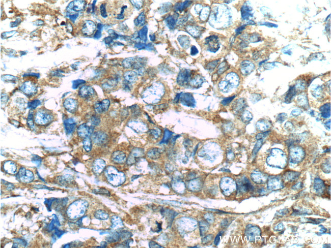 PKC zeta Antibody in Immunohistochemistry (Paraffin) (IHC (P))