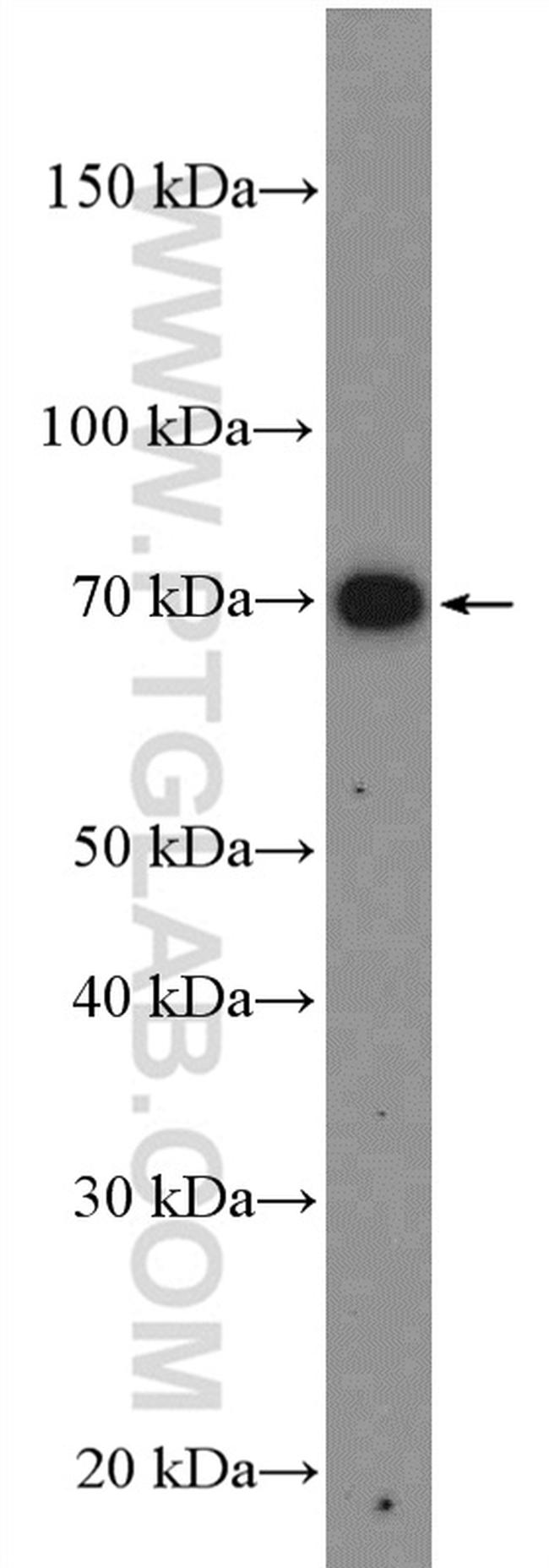 PKC zeta Antibody in Western Blot (WB)