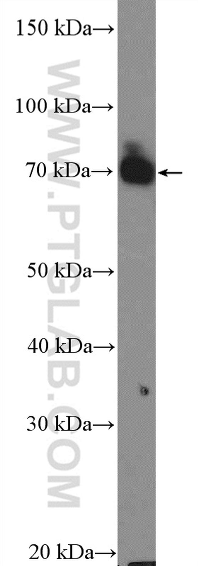 PKC zeta Antibody in Western Blot (WB)