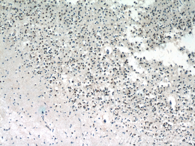 MECP2 Antibody in Immunohistochemistry (Paraffin) (IHC (P))