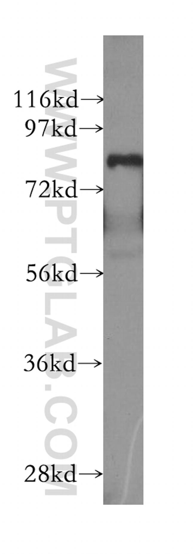 MECP2 Antibody in Western Blot (WB)