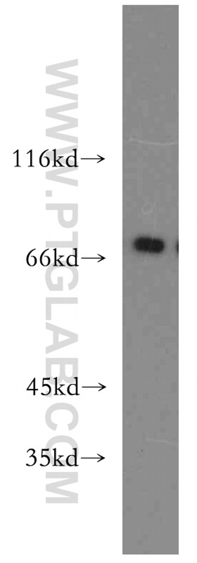 MECP2 Antibody in Western Blot (WB)