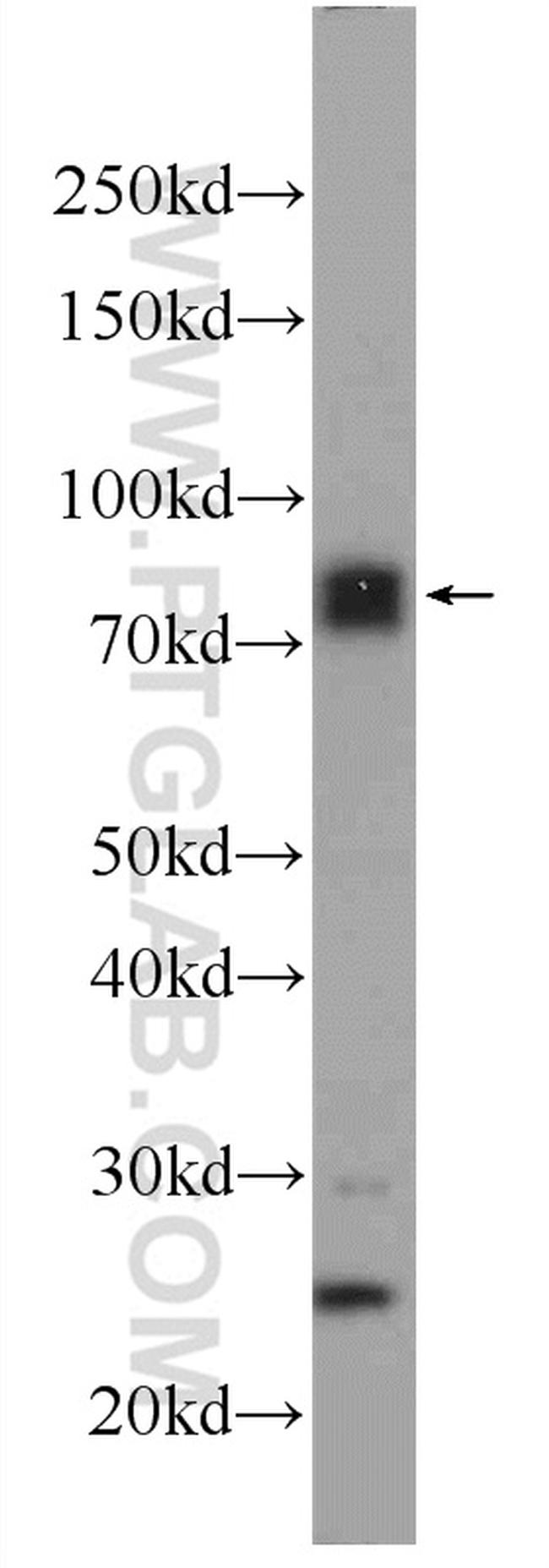 MECP2 Antibody in Western Blot (WB)