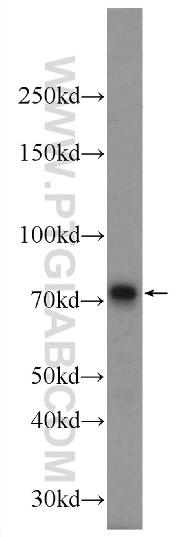 MECP2 Antibody in Western Blot (WB)