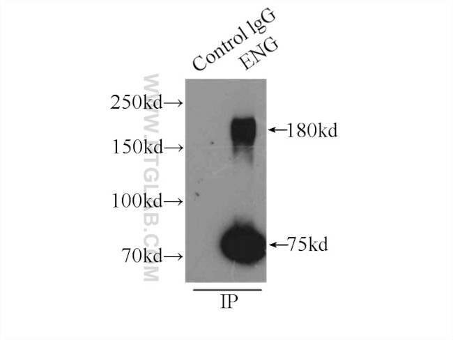 Endoglin/CD105 Antibody in Immunoprecipitation (IP)