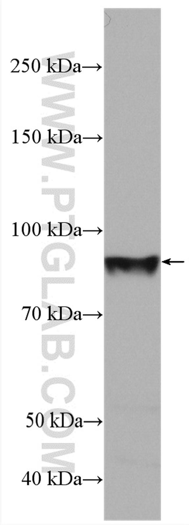 Endoglin/CD105 Antibody in Western Blot (WB)