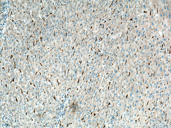 LYPLA3 Antibody in Immunohistochemistry (Paraffin) (IHC (P))