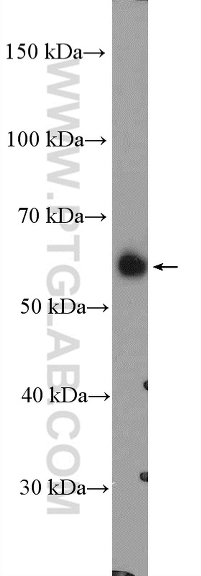 LYPLA3 Antibody in Western Blot (WB)