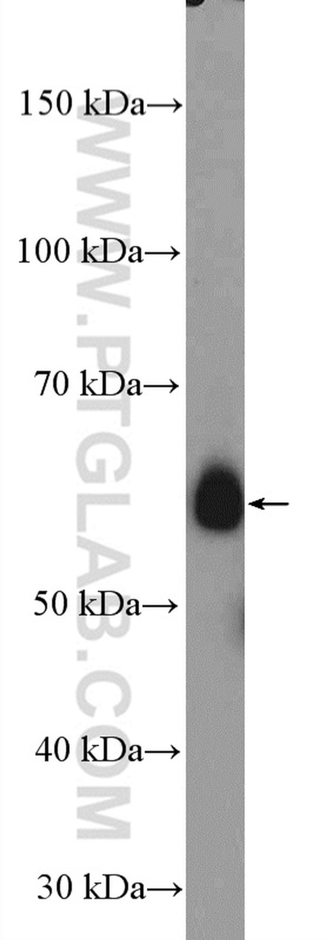 LYPLA3 Antibody in Western Blot (WB)