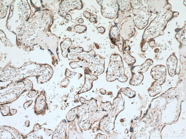 GM2A Antibody in Immunohistochemistry (Paraffin) (IHC (P))