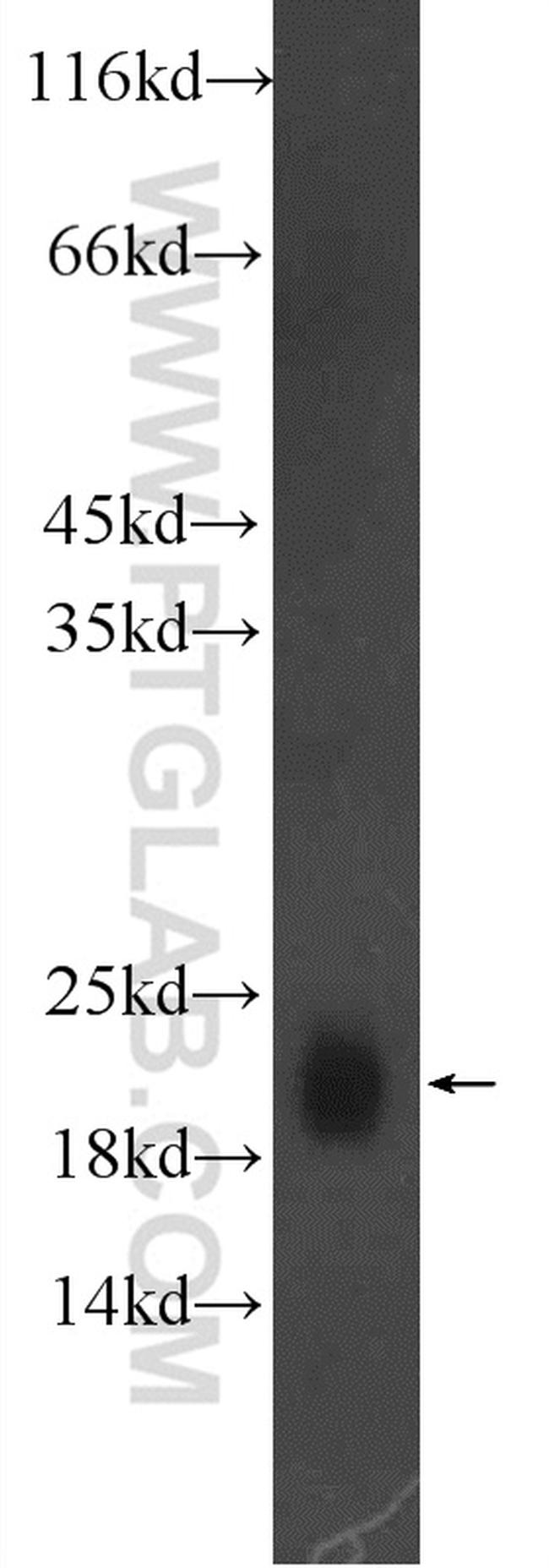 GM2A Antibody in Western Blot (WB)