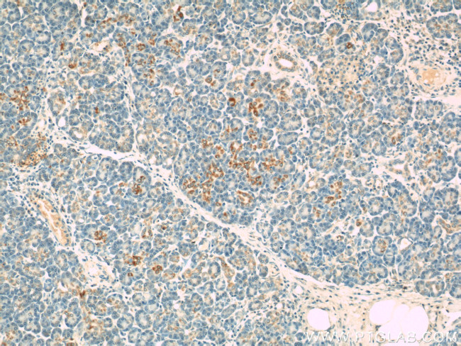 VDAC1/2 Antibody in Immunohistochemistry (Paraffin) (IHC (P))