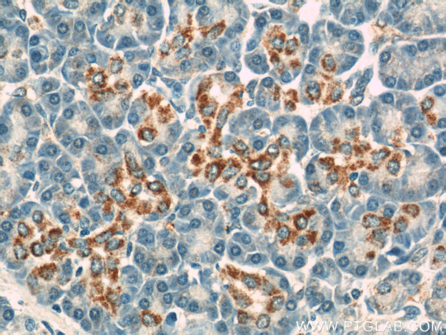 VDAC1/2 Antibody in Immunohistochemistry (Paraffin) (IHC (P))