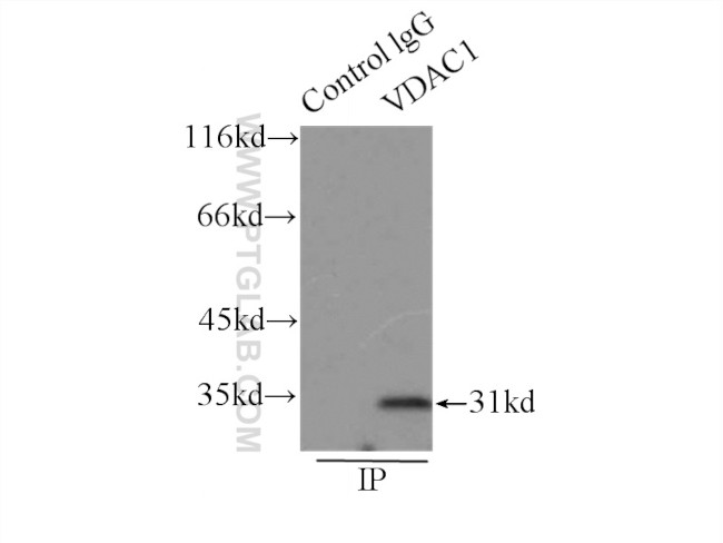 VDAC1/2 Antibody in Immunoprecipitation (IP)