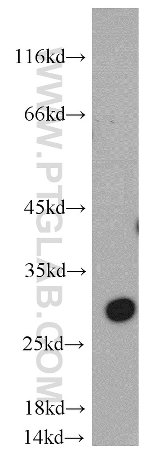 VDAC1/2 Antibody in Western Blot (WB)