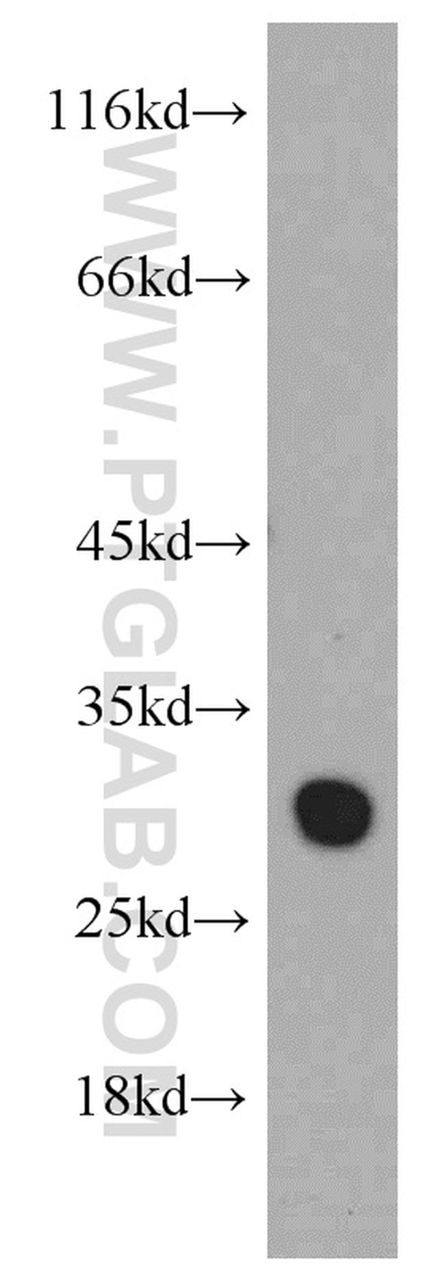 VDAC1/2 Antibody in Western Blot (WB)