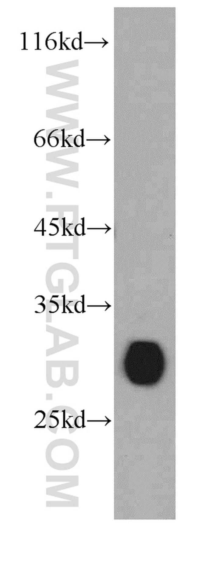 VDAC1/2 Antibody in Western Blot (WB)