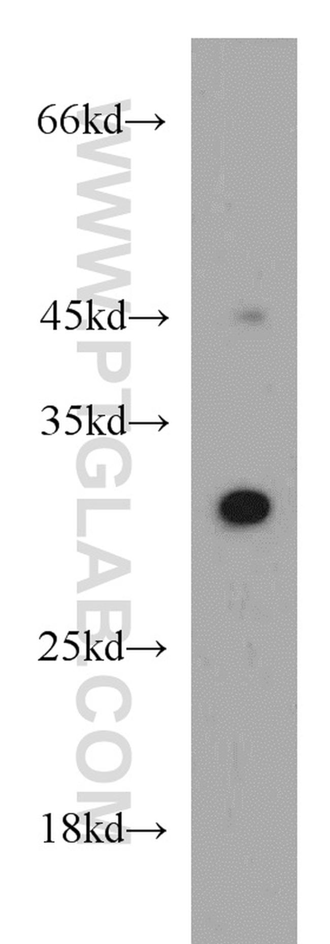 VDAC1/2 Antibody in Western Blot (WB)